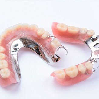 Two partial dentures with metal attachments