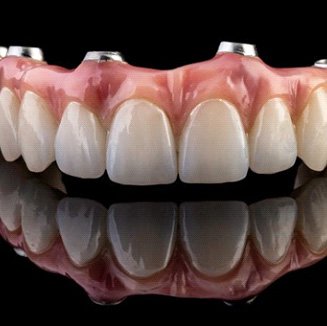 Implant dentures resting on dark reflective surface