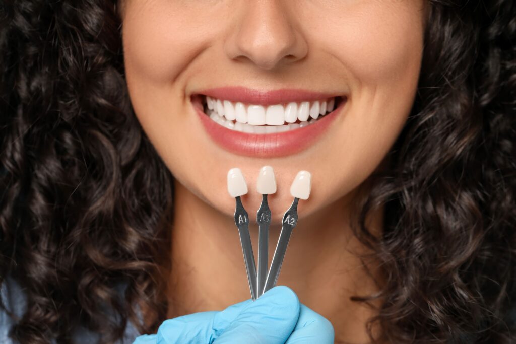 Nose-to-neck view of woman with curly hair with shade guide held to teeth